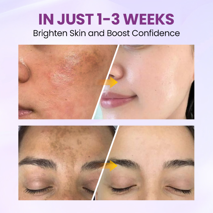 Clinclii™ Radiant Clear Blemish & Brightening Serum