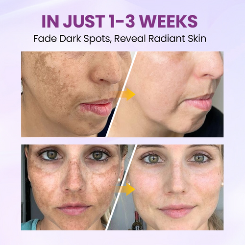 Clinclii™ Radiant Clear Blemish & Brightening Serum