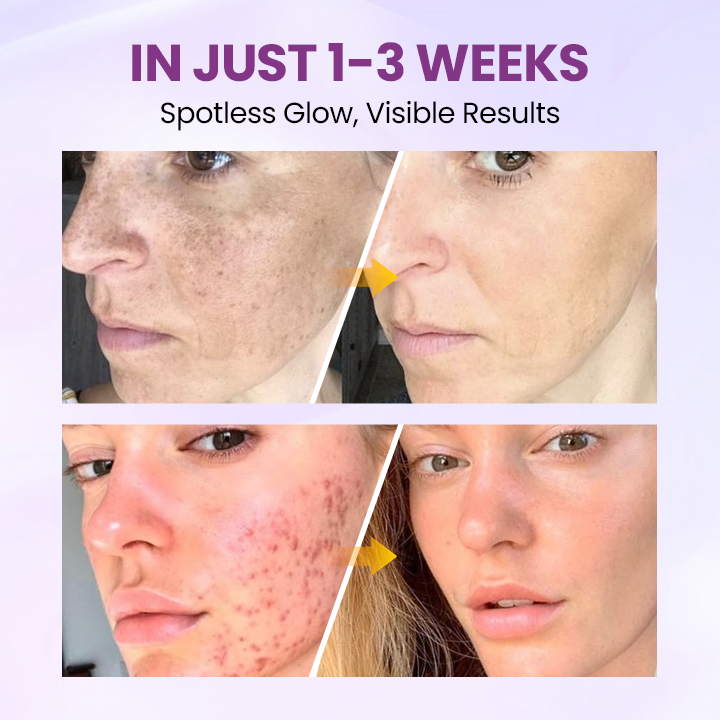 Clinclii™ Radiant Clear Blemish & Brightening Serum