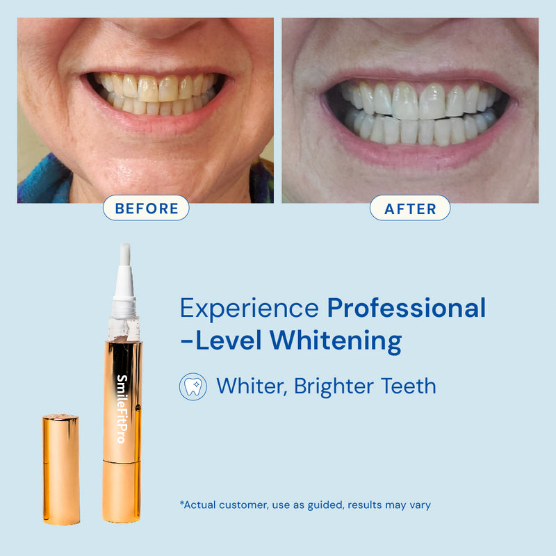 🔥 LAST DAY! 73% OFF FLASH SALE 💎 Diamond Whitening Pen | Visible Results in 7 Days ✨