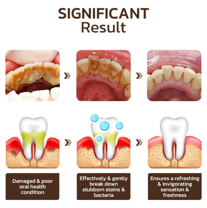 🔥Final - 3 Hours: 60% OFF Nicotinamide Whitening Toothpaste