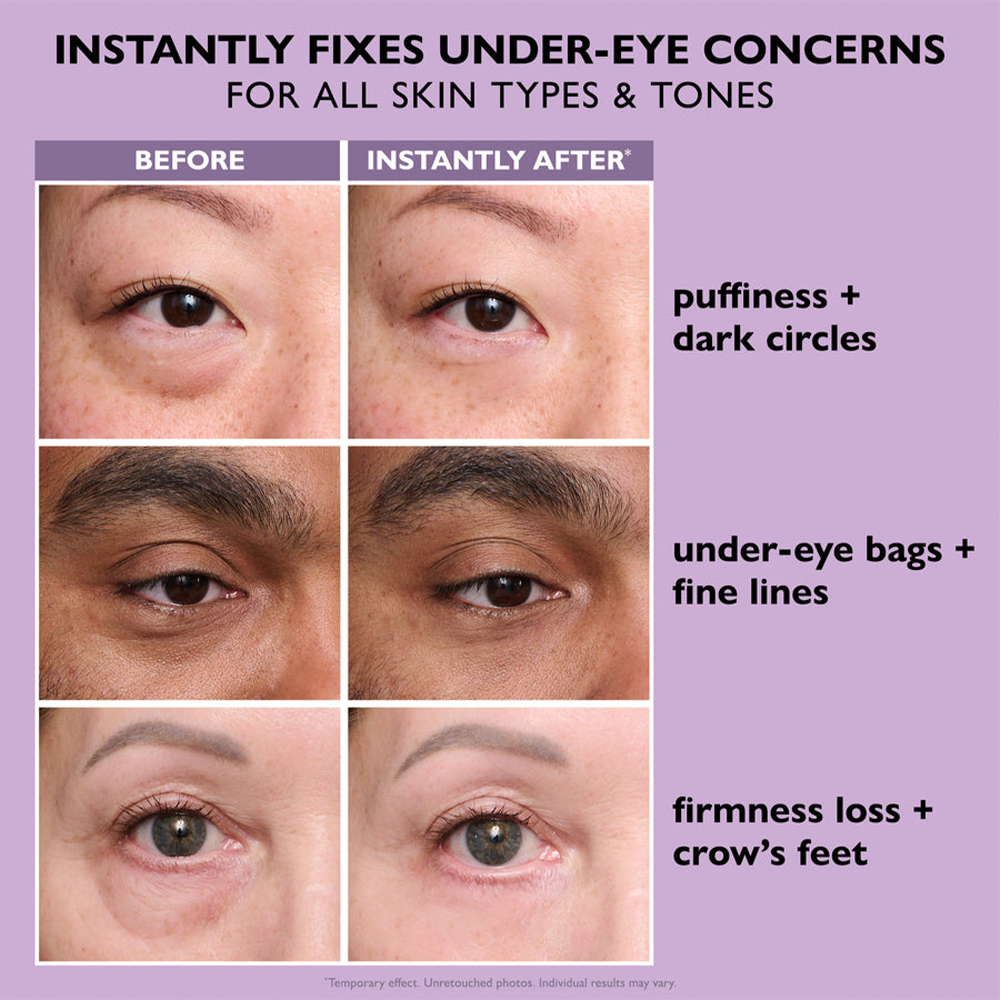 Last 3 hours: 70% off🔥Instant Firming Eye Serum, new formula, ultimate lifting and smoothing effect