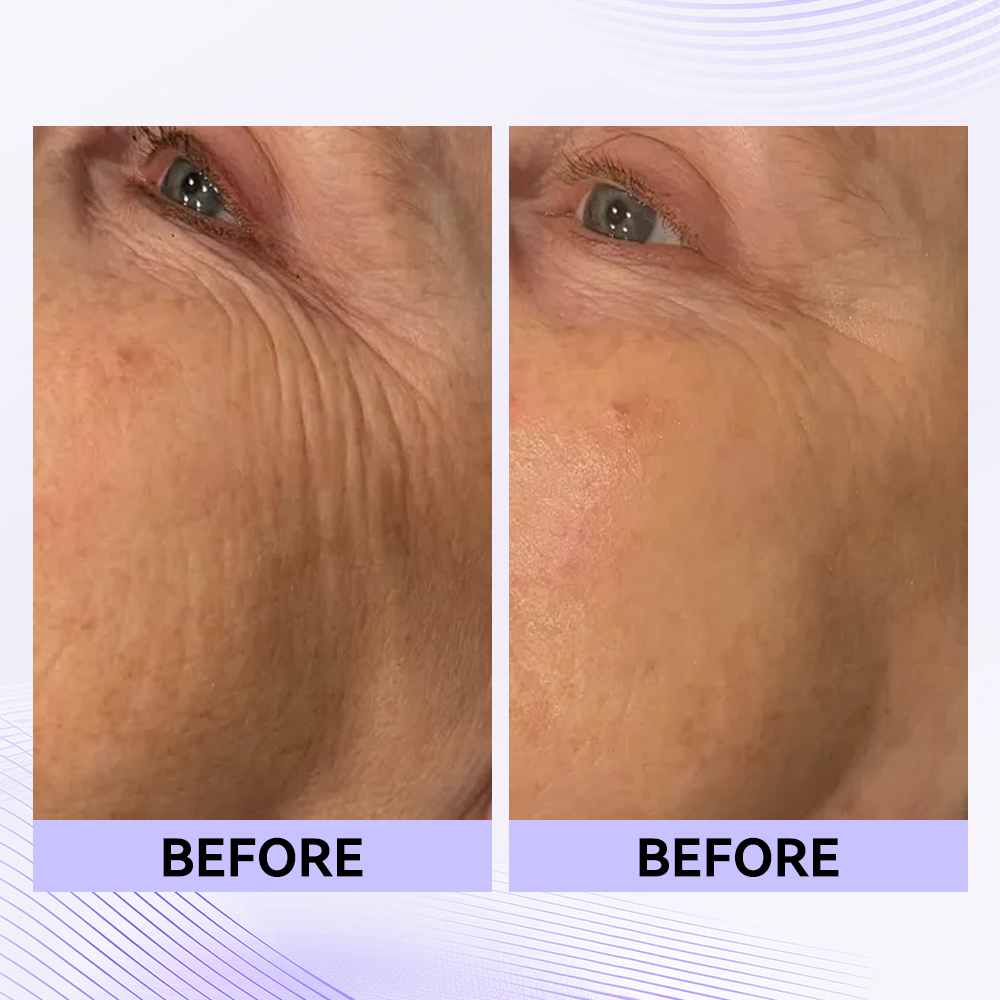 Last 3 hours: 70% off🔥Instant Firming Eye Serum, new formula, ultimate lifting and smoothing effect