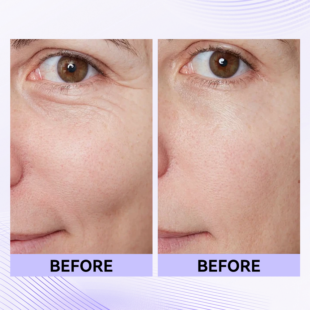 Last 3 hours: 70% off🔥Instant Firming Eye Serum, new formula, ultimate lifting and smoothing effect