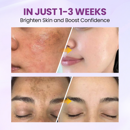 Clinclii™ Radiant Clear Blemish & Brightening Serum