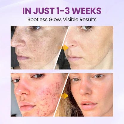 Clinclii™ Radiant Clear Blemish & Brightening Serum