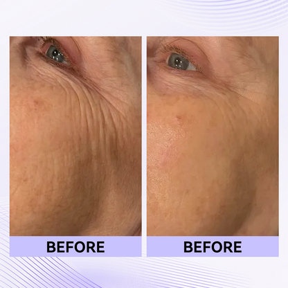Last 3 hours: 70% off🔥Instant Firming Eye Serum, new formula, ultimate lifting and smoothing effect