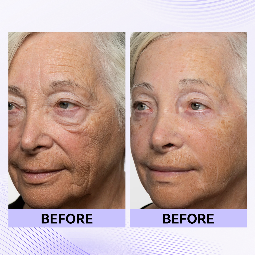 Last 3 hours: 70% off🔥Instant Firming Eye Serum, new formula, ultimate lifting and smoothing effect