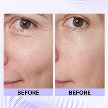 Last 3 hours: 70% off🔥Instant Firming Eye Serum, new formula, ultimate lifting and smoothing effect